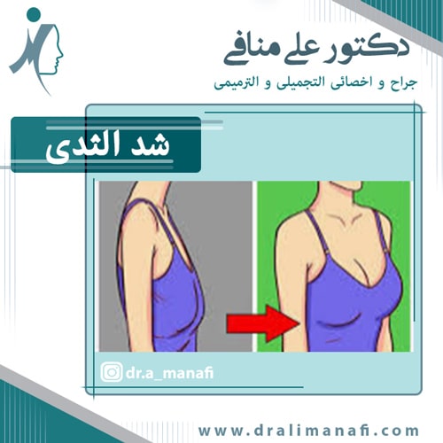 جراحة الثدي (ماموبلاستي)